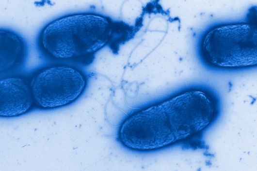 Bakterien der Art Pseudomonas aeruginosa sind äußerst widerstandfähig und kommen fast überall vor. © HZI/Manfred Rohde