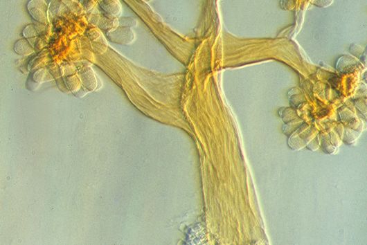 Fruchtkörper von Myxobakterien unter dem Lichtmikroskop.