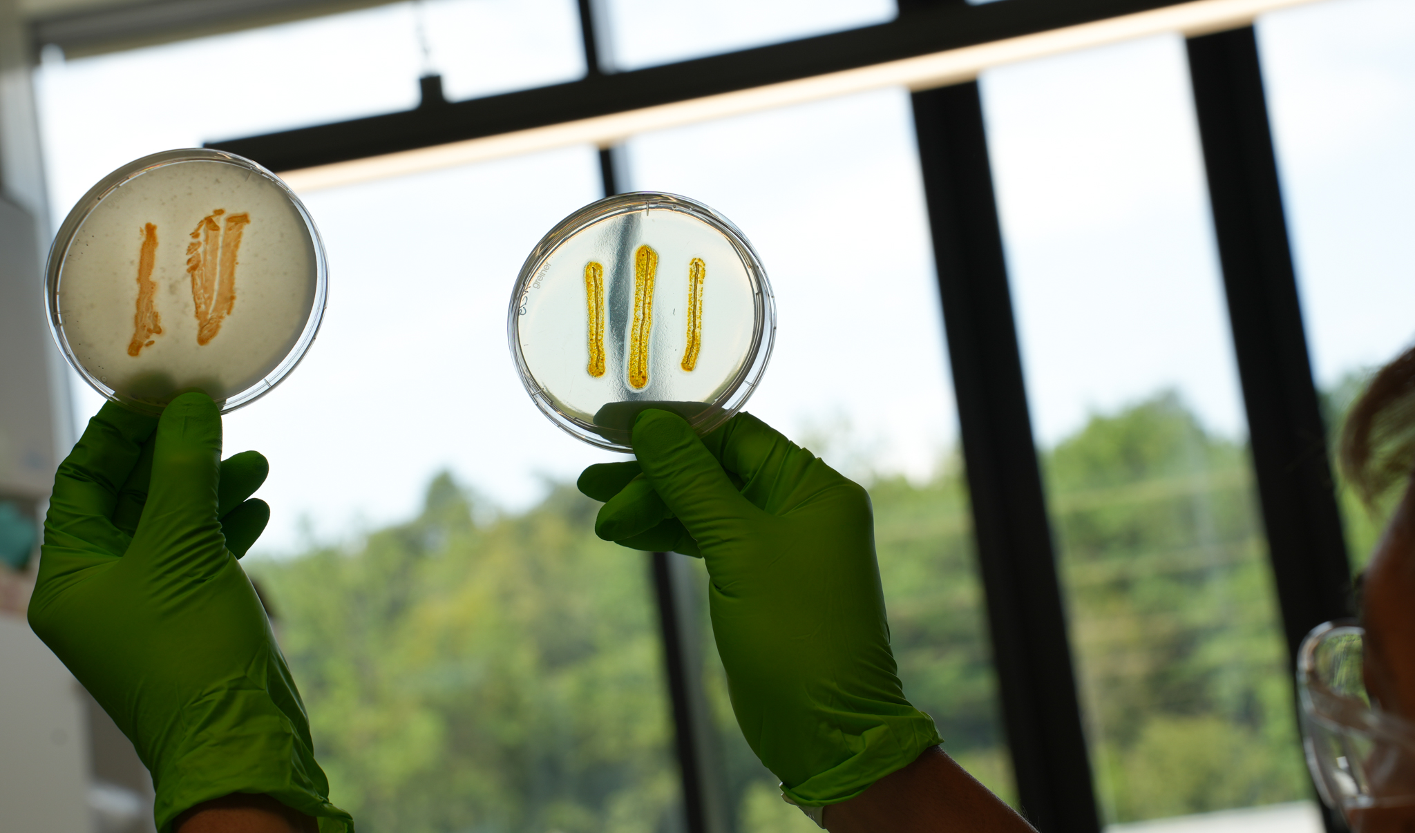 Two petri dishes containing myxobacteria are held aloft, one in each hand