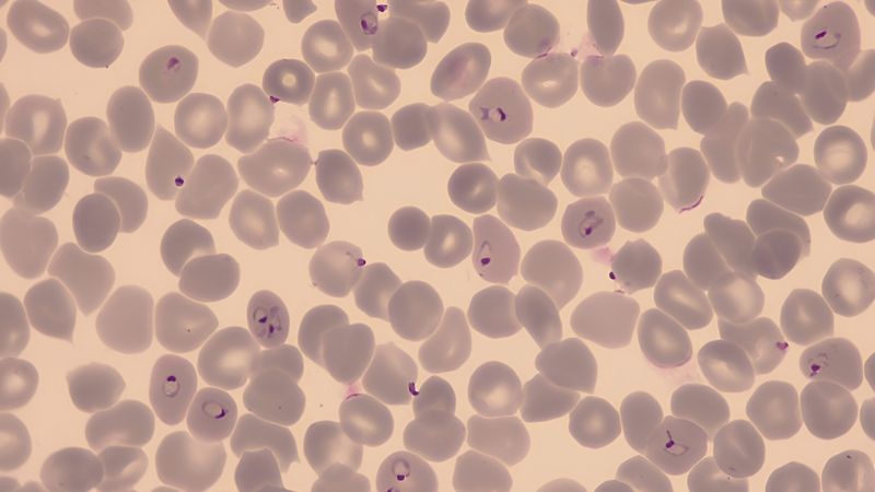 Red blood cells infected with Plasmodium falciparum