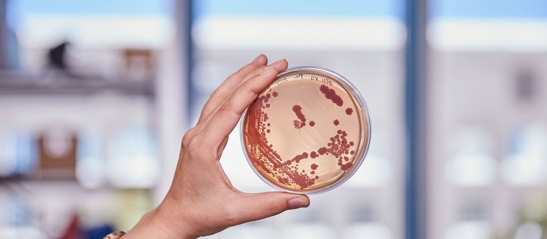 Petri dish with bacteria