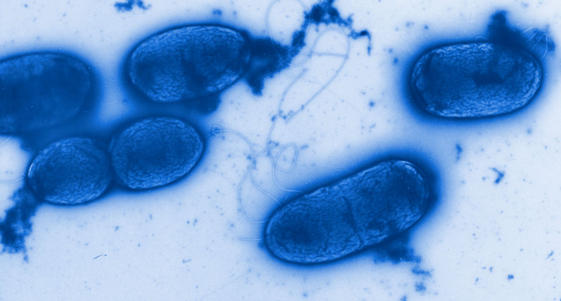 Bakterien der Art Pseudomonas aeruginosa sind äußerst widerstandfähig und kommen fast überall vor. © HZI/Manfred Rohde