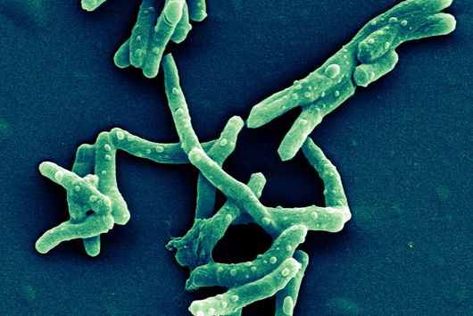 Scanning electron micrograph of Mycobacterium tuberculosis