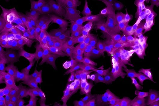 Fluorescence microscopy of cells in magenta and blue