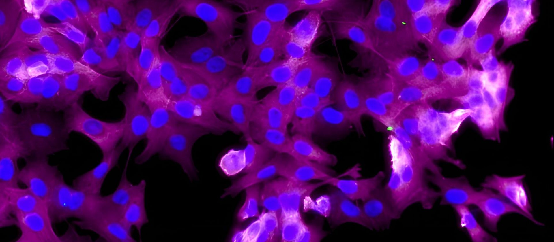 Fluorescence microscopy of cells in magenta and blue