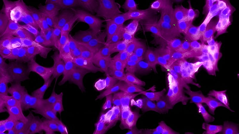 Fluorescence microscopy of cells in magenta and blue