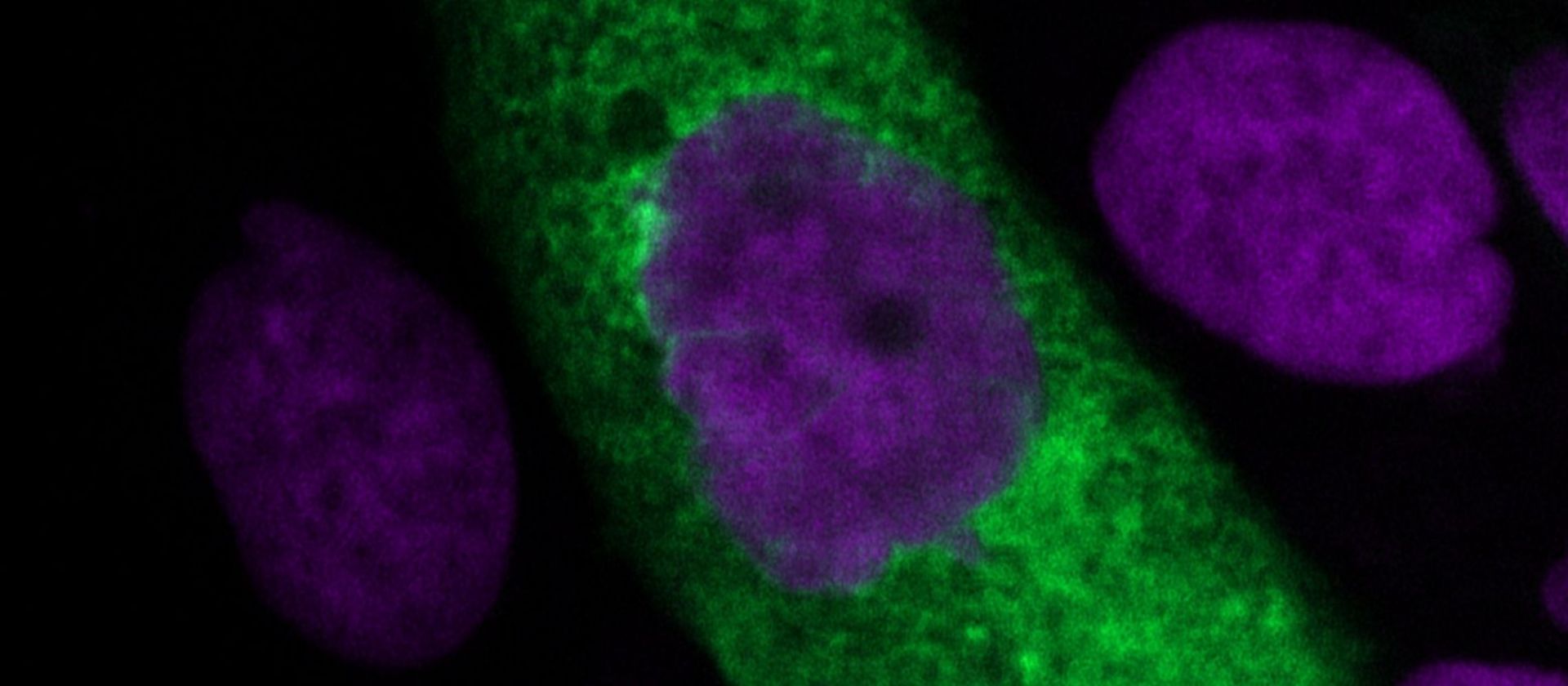 Mit SARS-CoV-2 infizierte Lungenzelle bildet neue Viruspartikel (grün) in ihrem Zytoplasma (violett: Zellkerne). ©HZI/Ulfert Rand