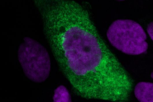 Mit SARS-CoV-2 infizierte Lungenzelle bildet neue Viruspartikel (grün) in ihrem Zytoplasma (violett: Zellkerne). ©HZI/Ulfert Rand