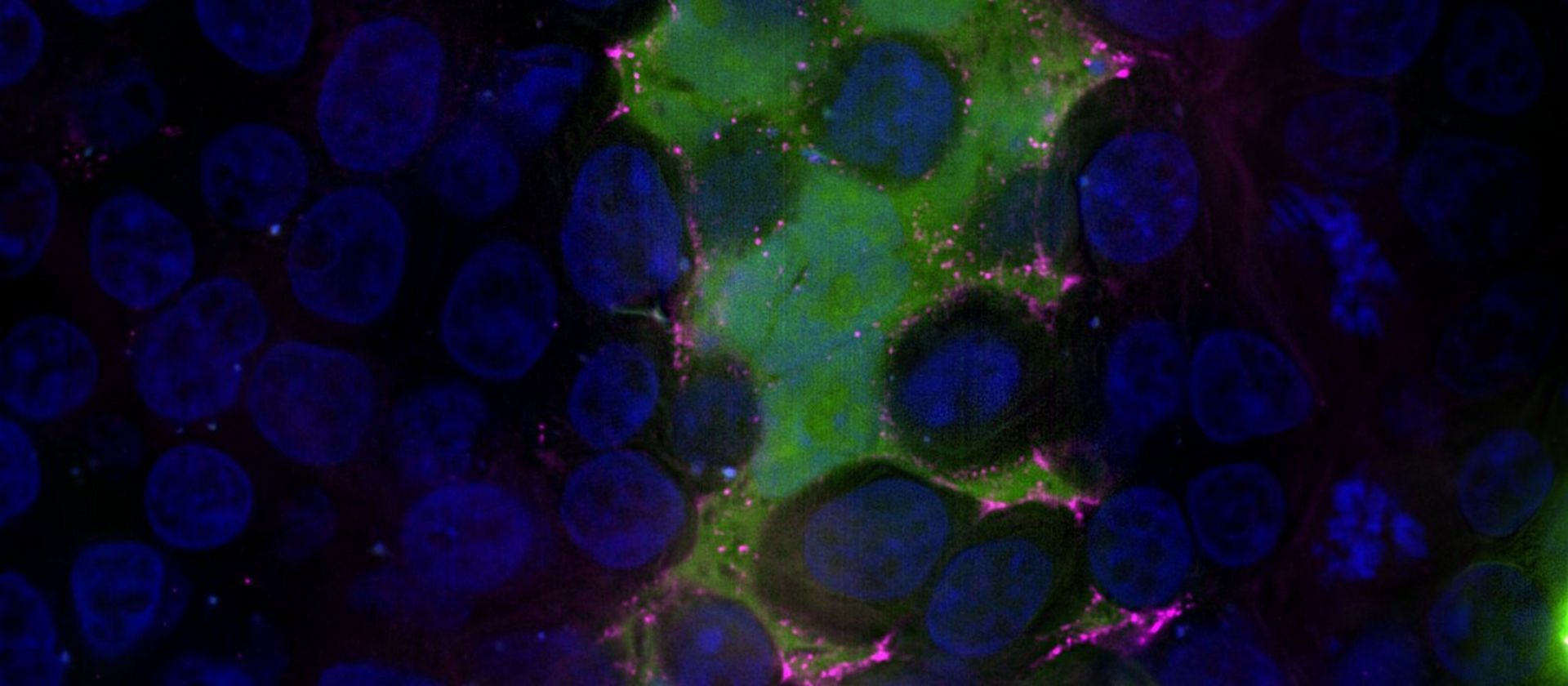 Mikroskopisches Bild von RSV infizierten Zellen.