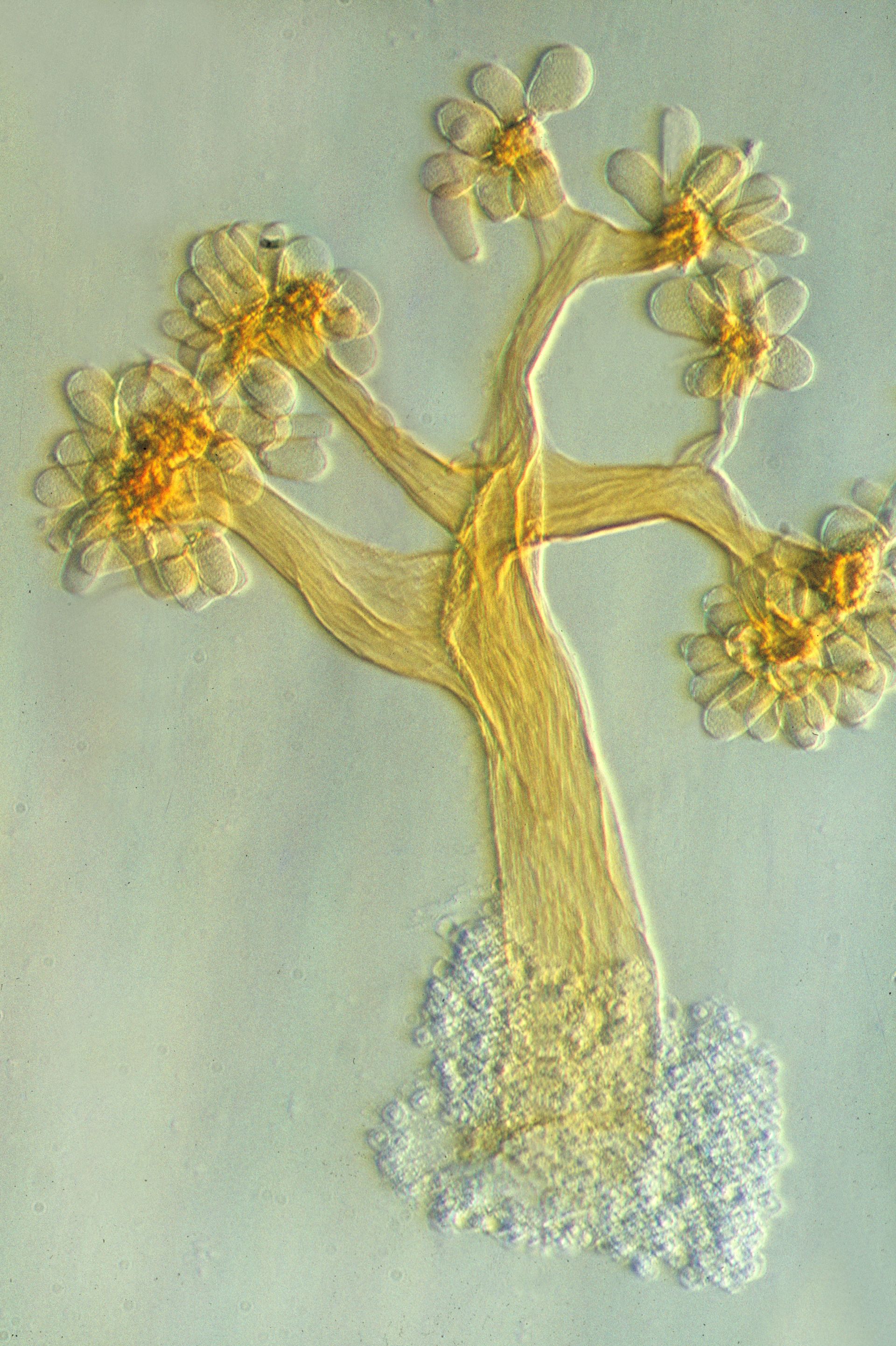 Fruchtkörper von Myxobakterien unter dem Lichtmikroskop.