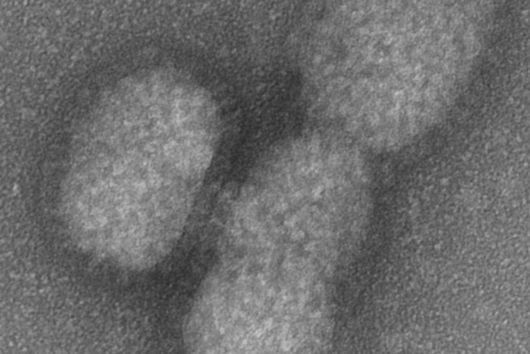 Electron micrograph of influenza