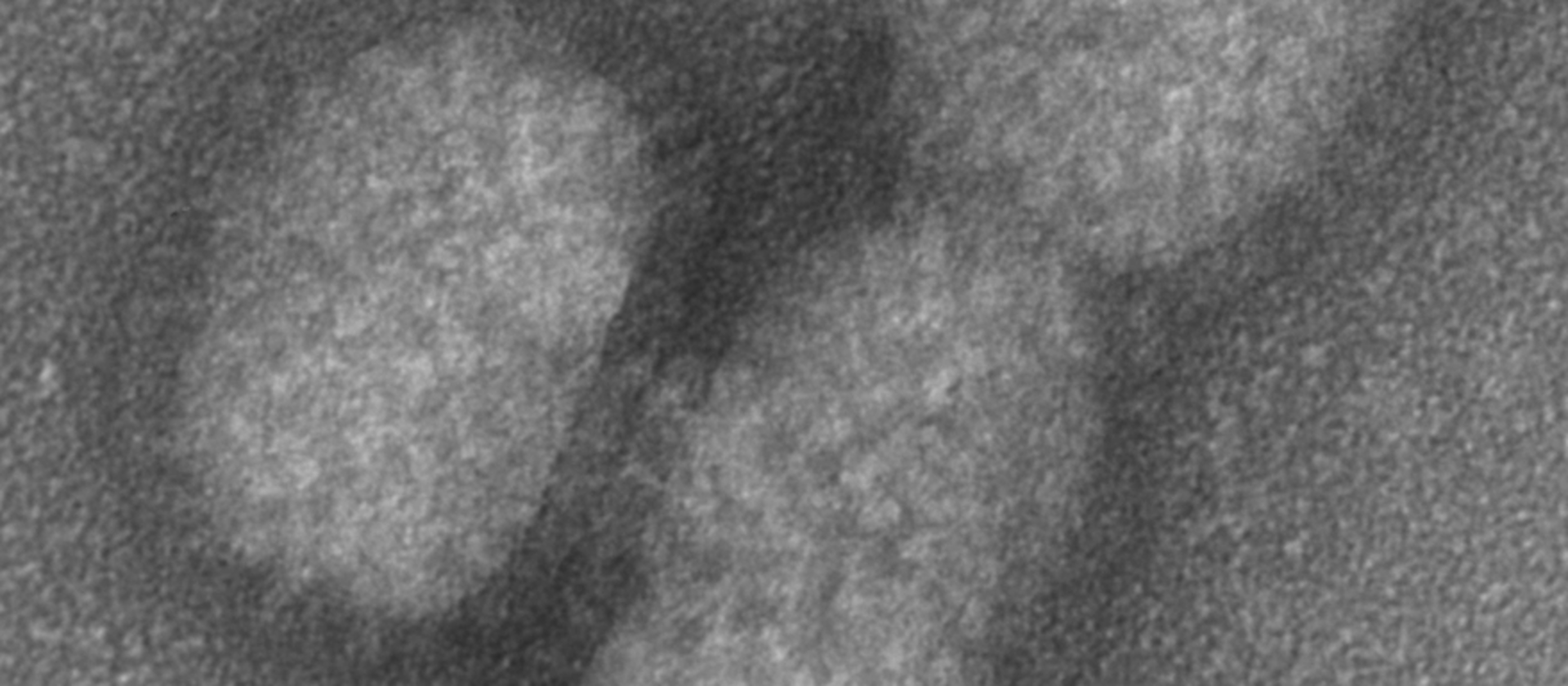 Electron micrograph of influenza