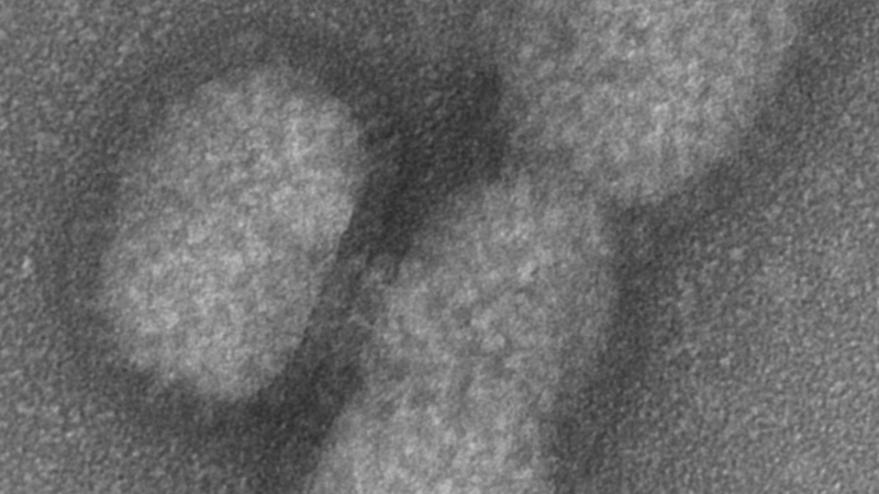 Electron micrograph of influenza