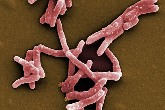 Scanning electron microscope image of Mycobacterium tuberculosis