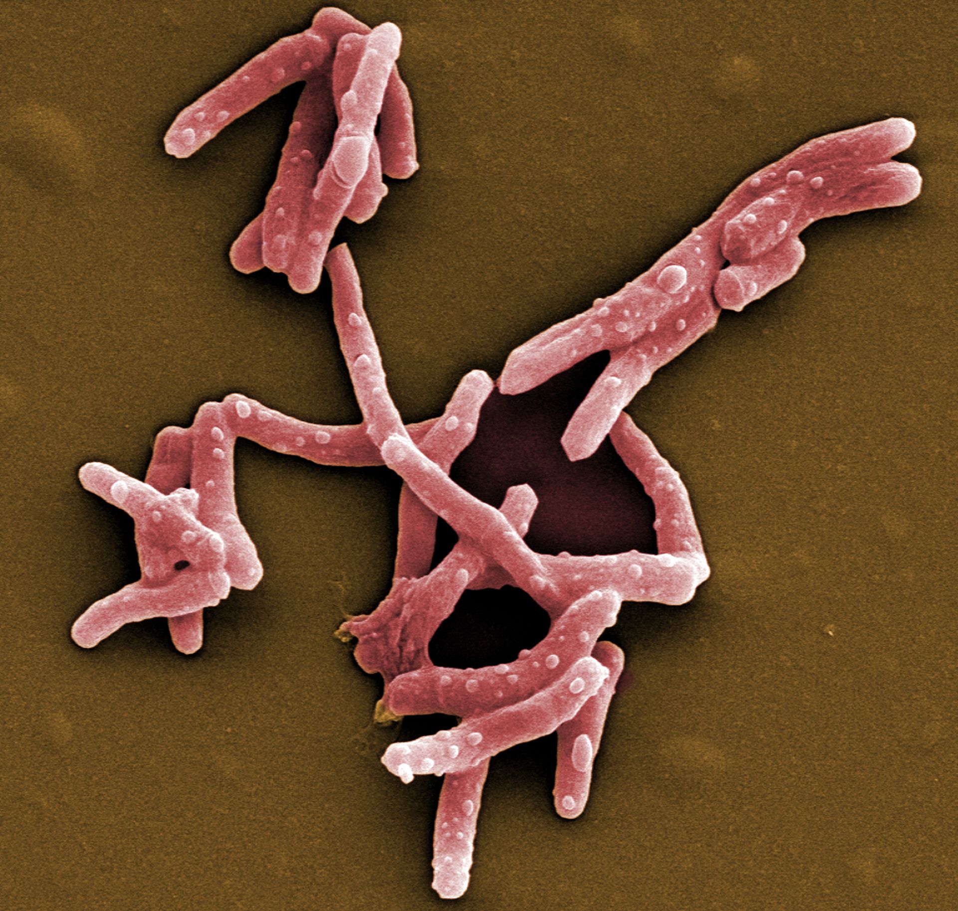 Rasterelektronenmikroskopische Aufnahme von Mycobacterium tuberculosis. 